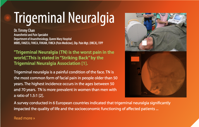 Trigeminal Neuralgia